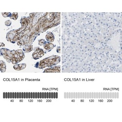 COL15A1 Antibody, Novus Biologicals:Antibodies:Primary Antibodies